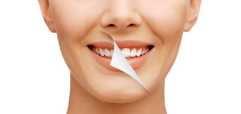 Dr. Namratha Chandrahari discussing smile makeover treatment options with a patient at Enamel Dental Banjara Hills