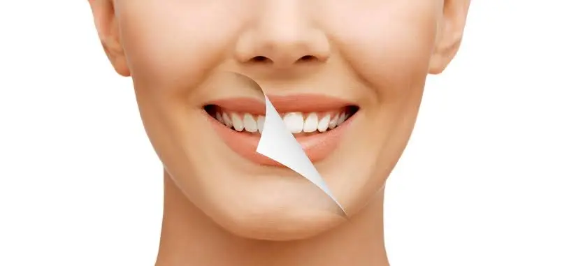 Smile makeover treatment consultation for a healthier, confident smile.
